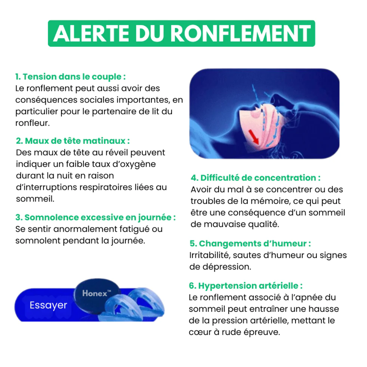 Honex™ - Dispositif Anti-Ronflement Universel